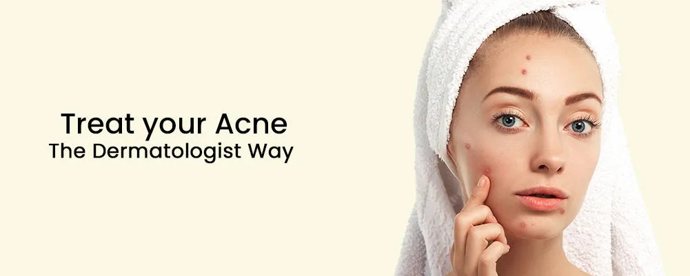 Treat your Acne- The Dermatologist Way