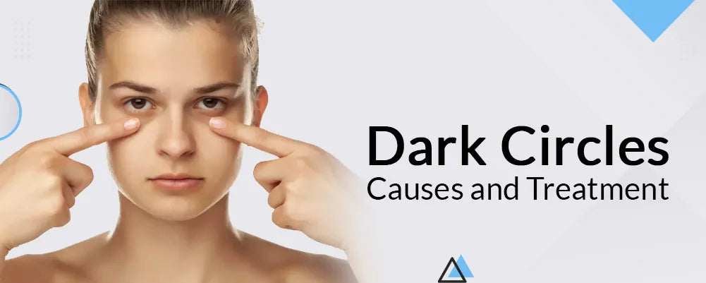 Dark circles