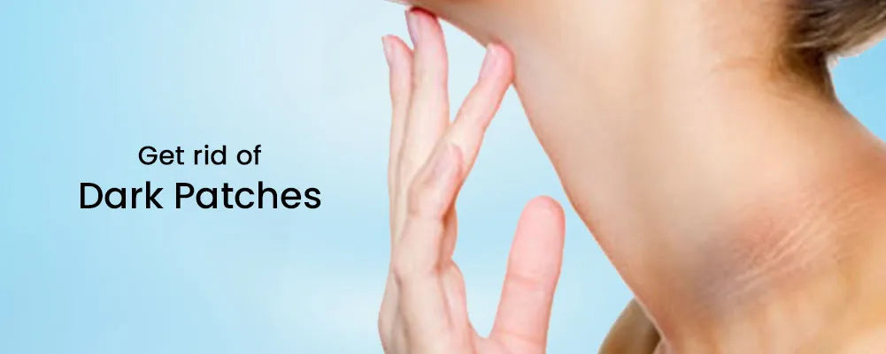 Why your knees, underarms, neck, and elbows are dark?