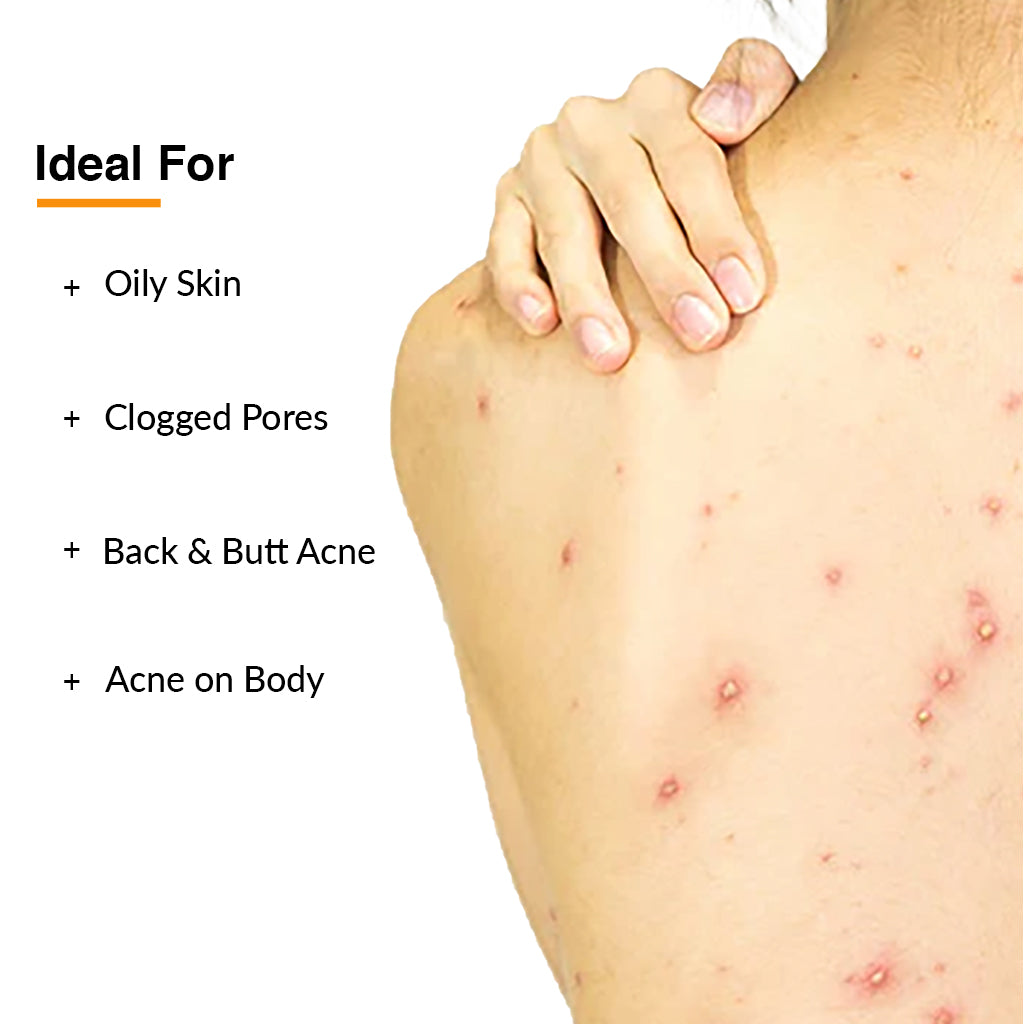 Salyzap Body Wash - Acne Treatment