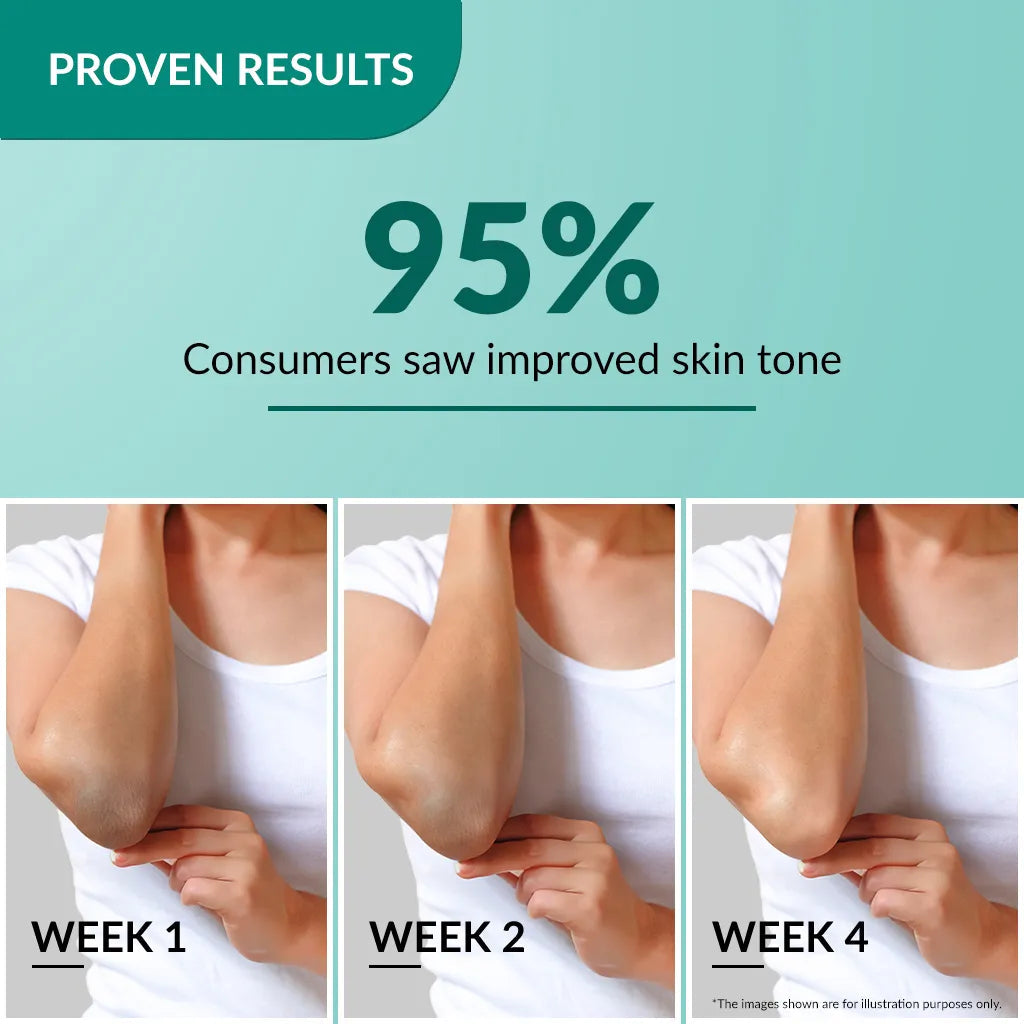 Nigrifix Cream - Hyperpigmentation - Acanthosis Nigricans